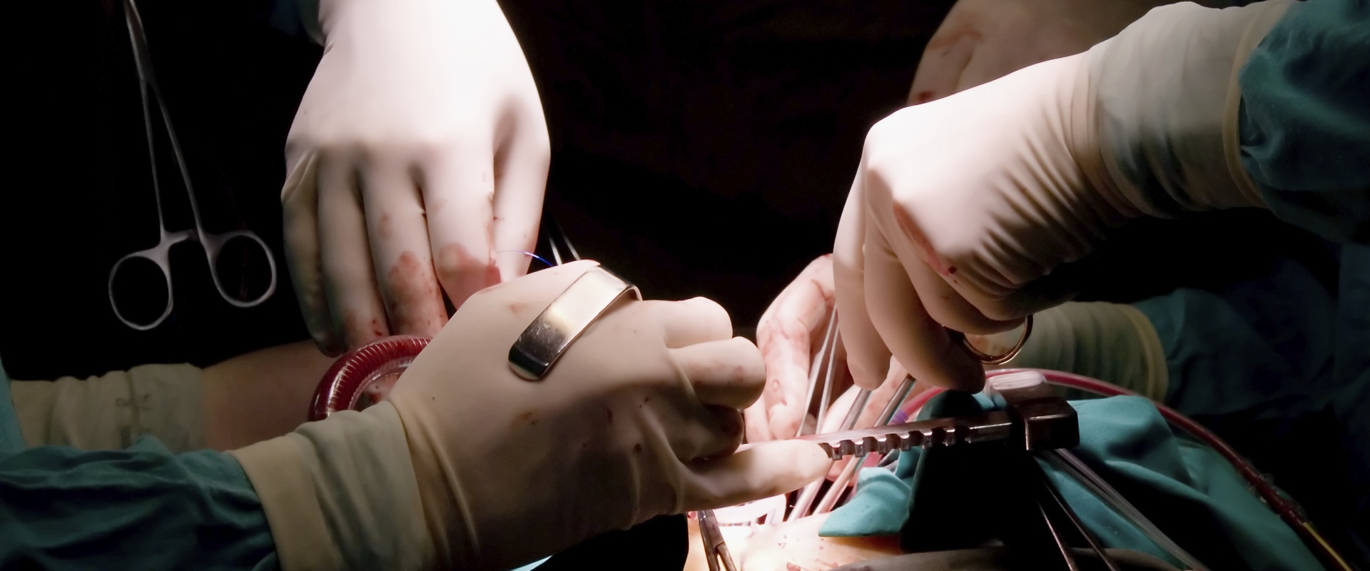 What surgery has the highest complication rate?