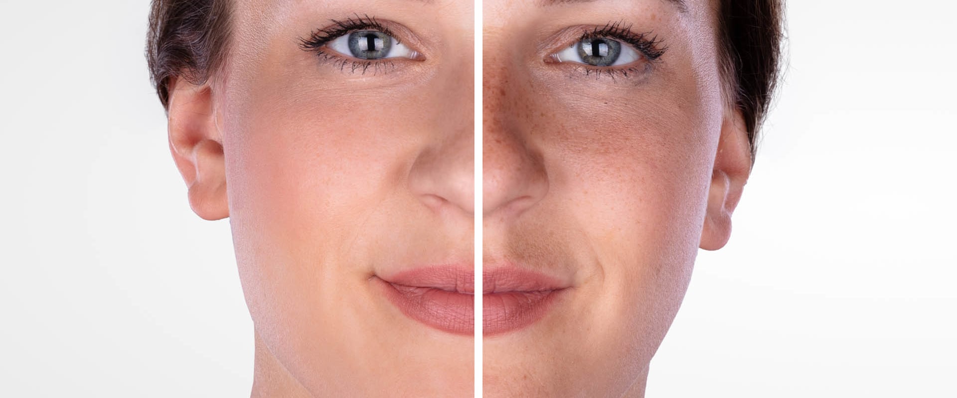 What class of med is botox?