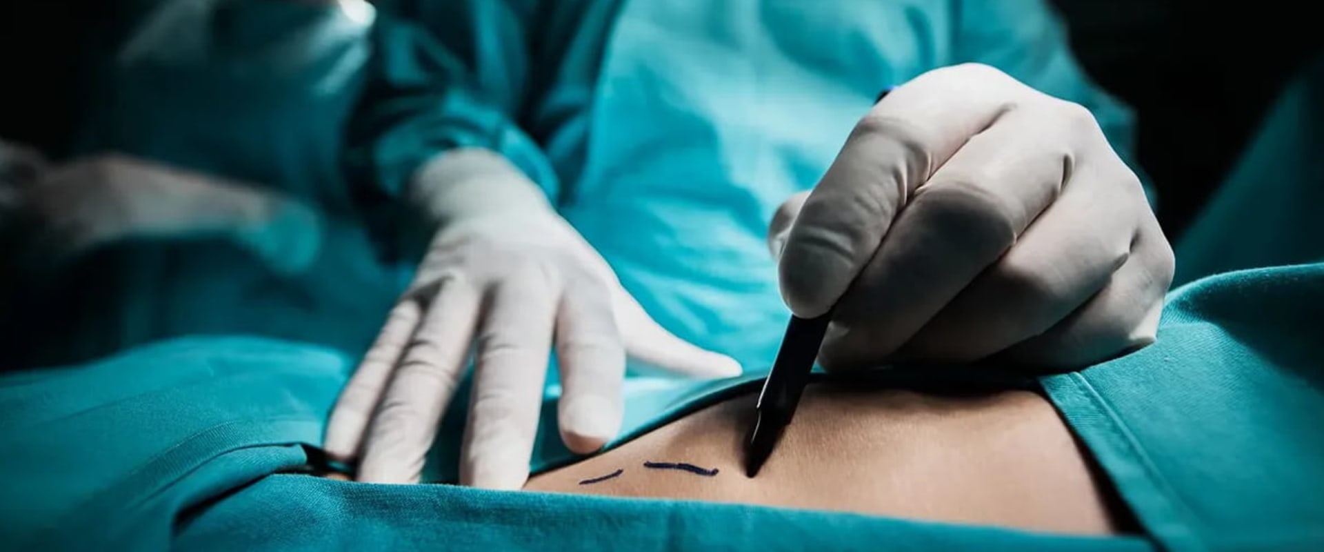 What is the riskiest cosmetic surgery?