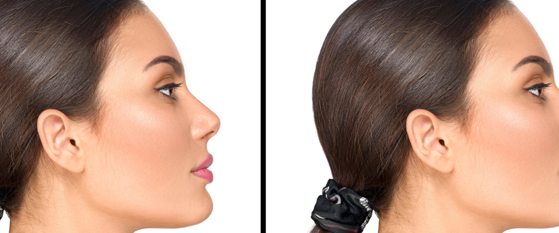 What is the most painful plastic surgery to recover from?