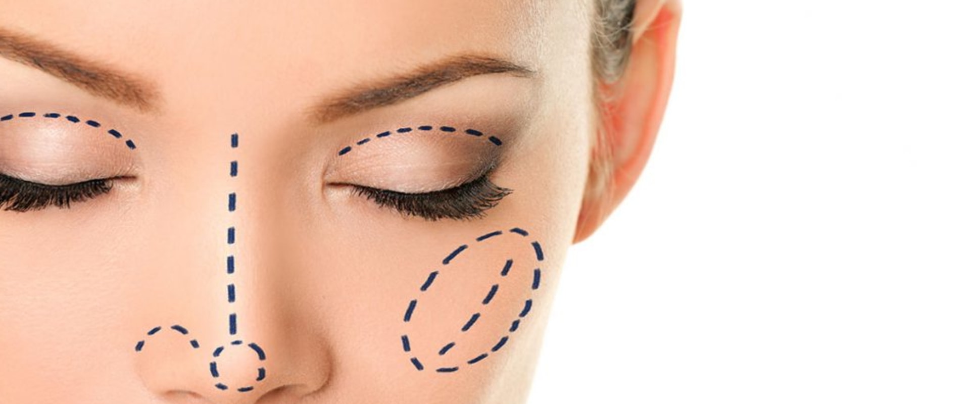 What are the different types of plastic surgery?