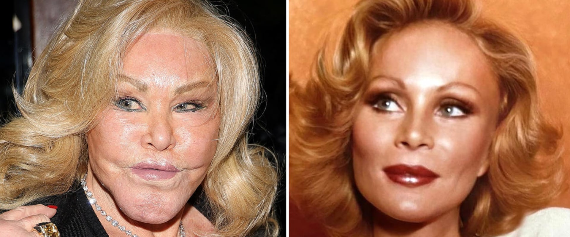 Are people satisfied after plastic surgery?