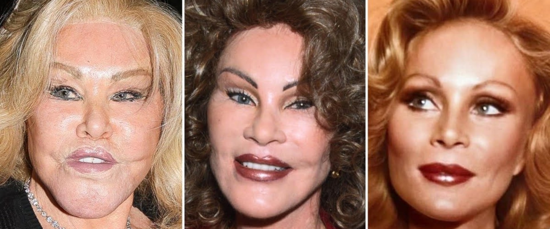 What is the real name for plastic surgery?