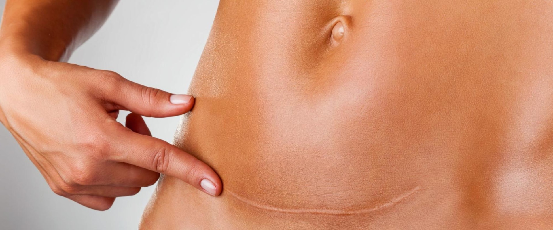 What are red flags after a tummy tuck?