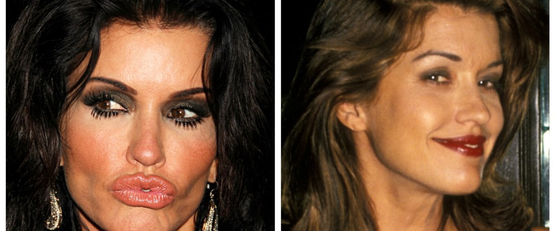 What percentage of people regret their plastic surgery?
