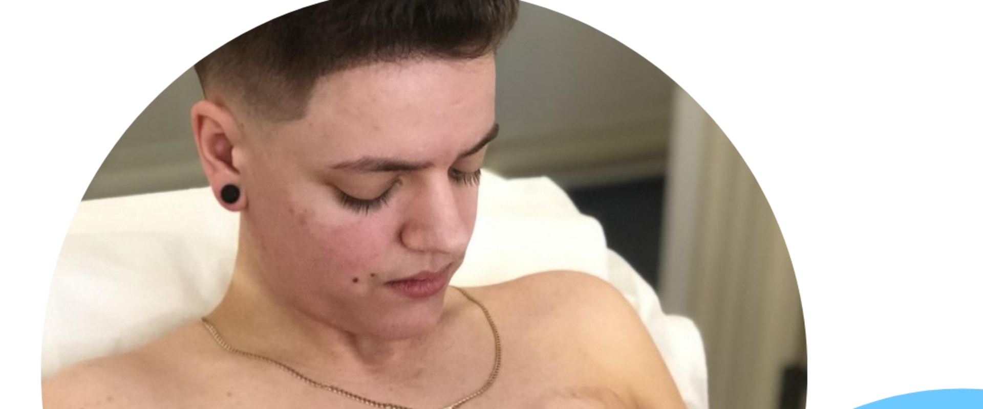 How long can you not lift after top surgery?