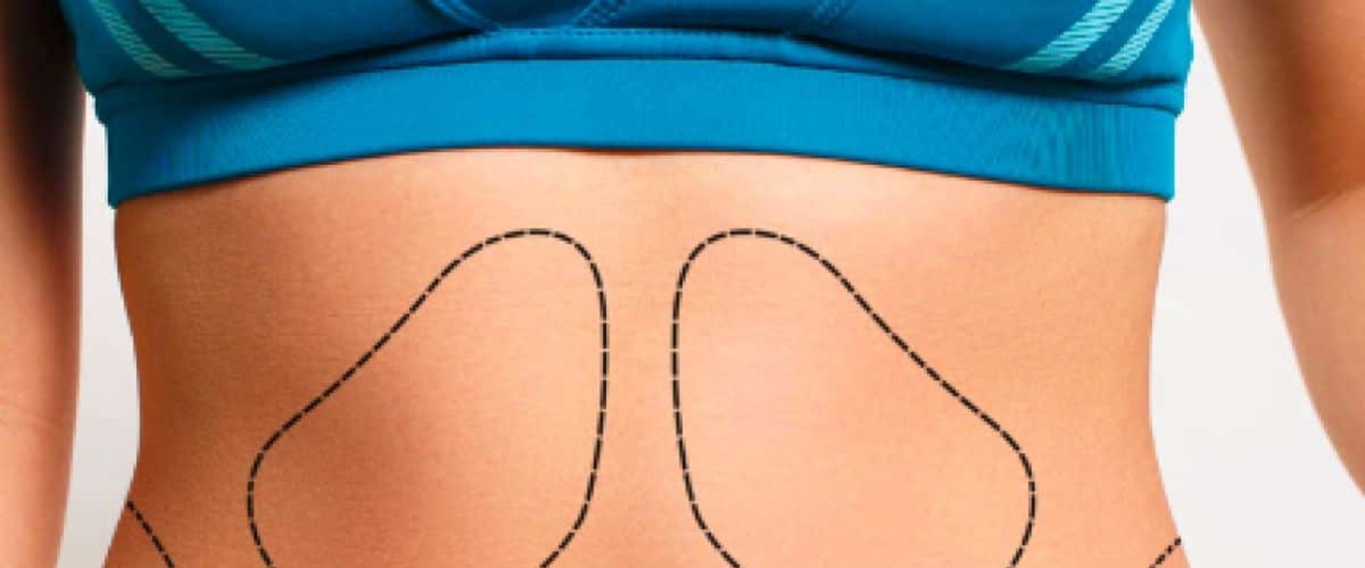 Do nerves grow back after tummy tuck?