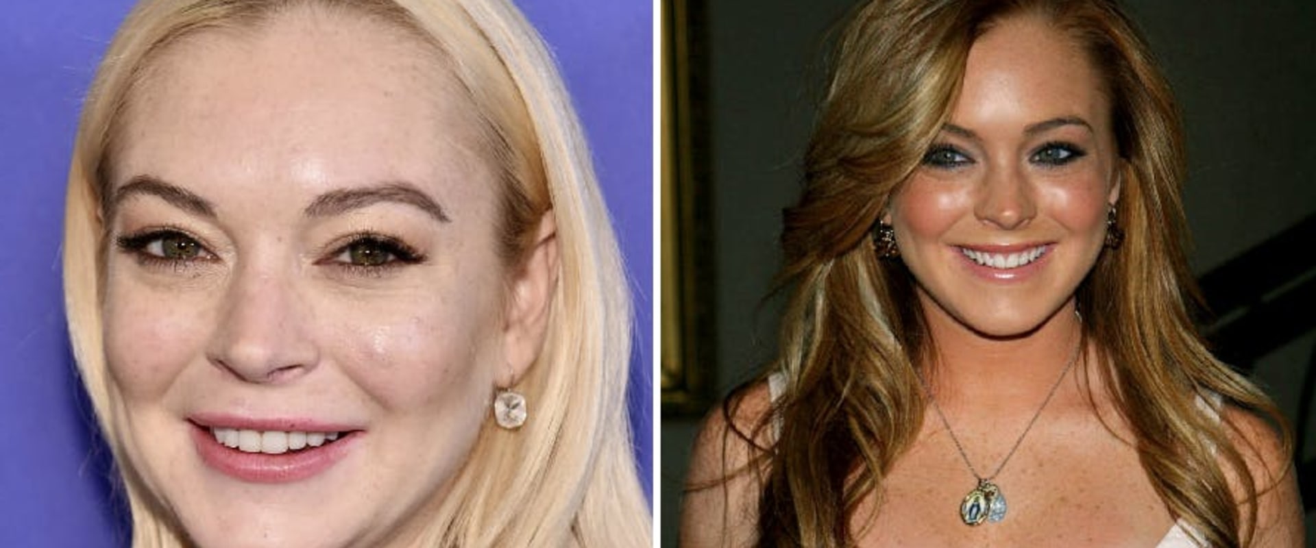 Do people change after plastic surgery?