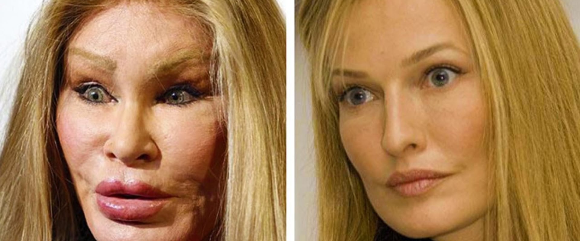 How many people disagree with plastic surgery?