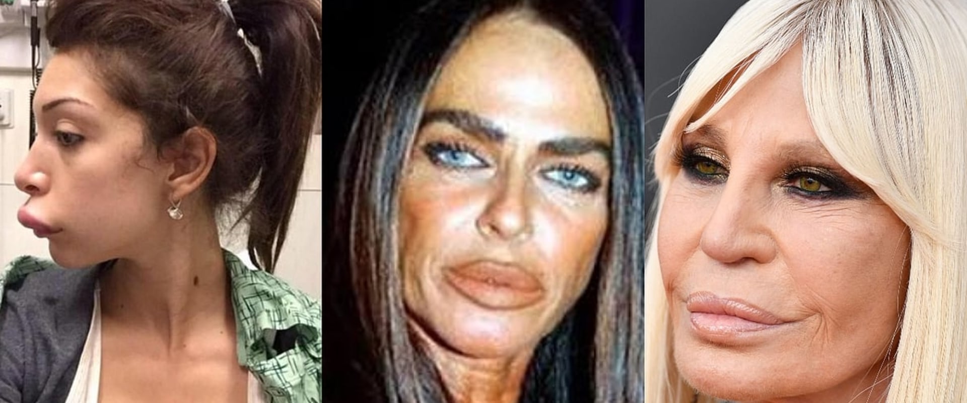 How often is cosmetic surgery botched?