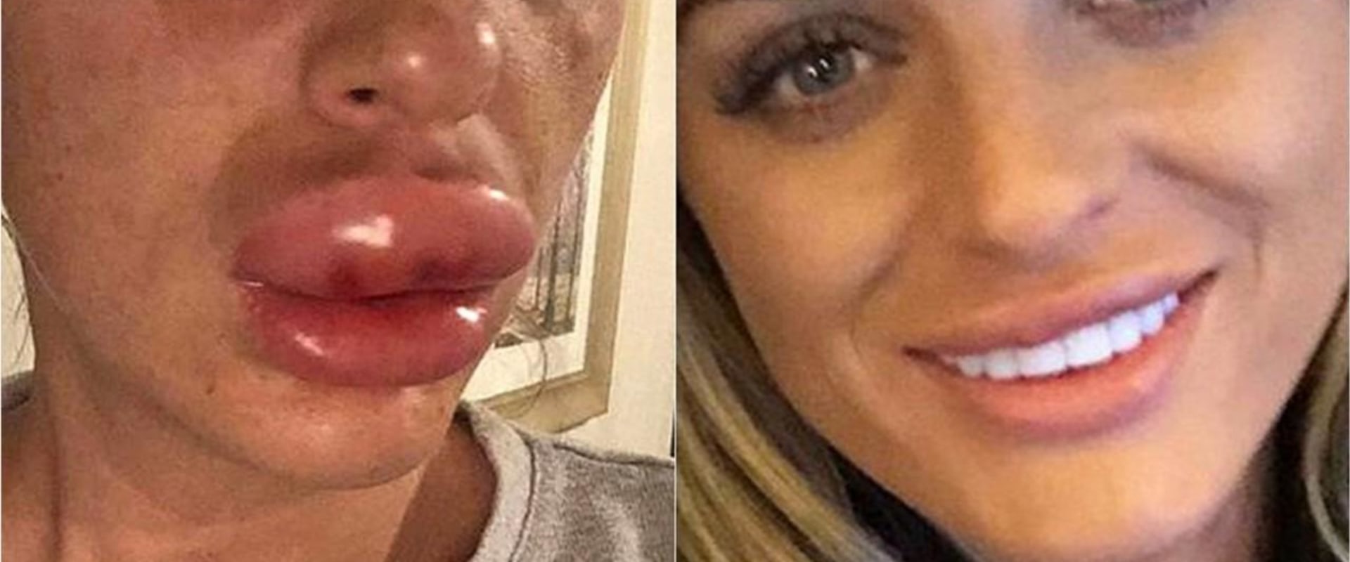 What percent of plastic surgeries go wrong?