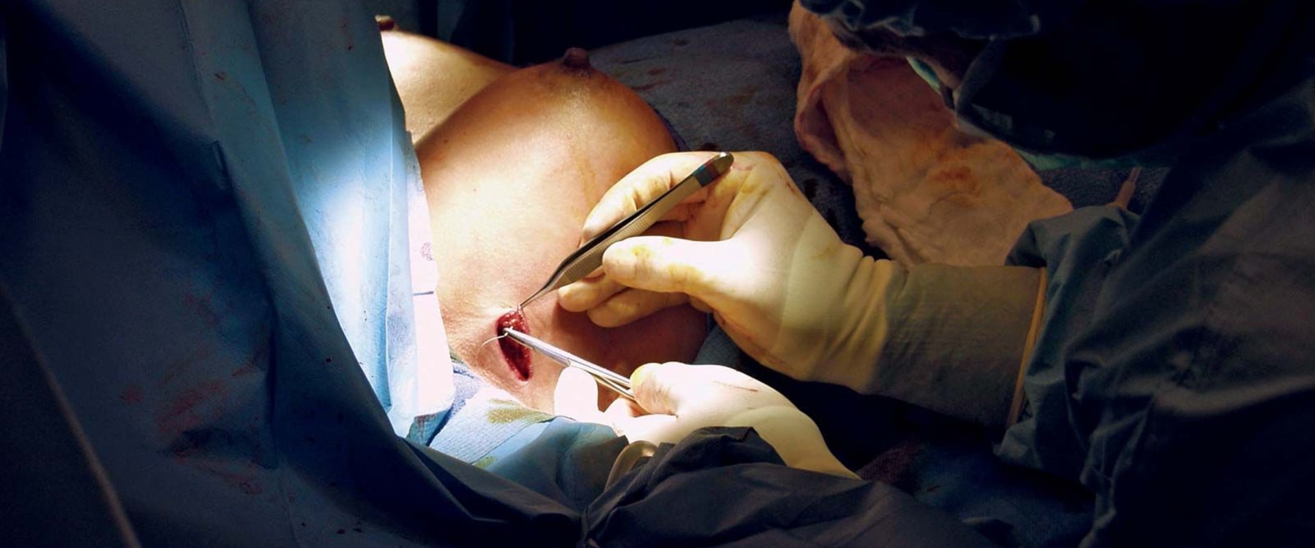 What is a fancy name for plastic surgery?