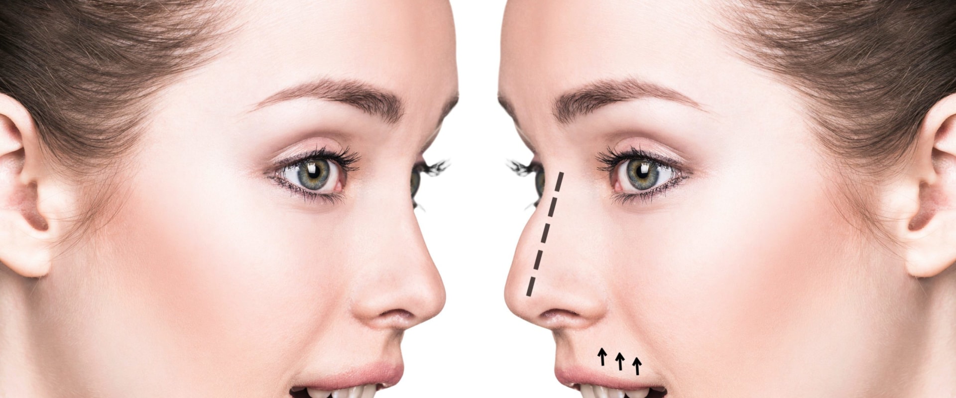 What is a positive impact on plastic surgery?