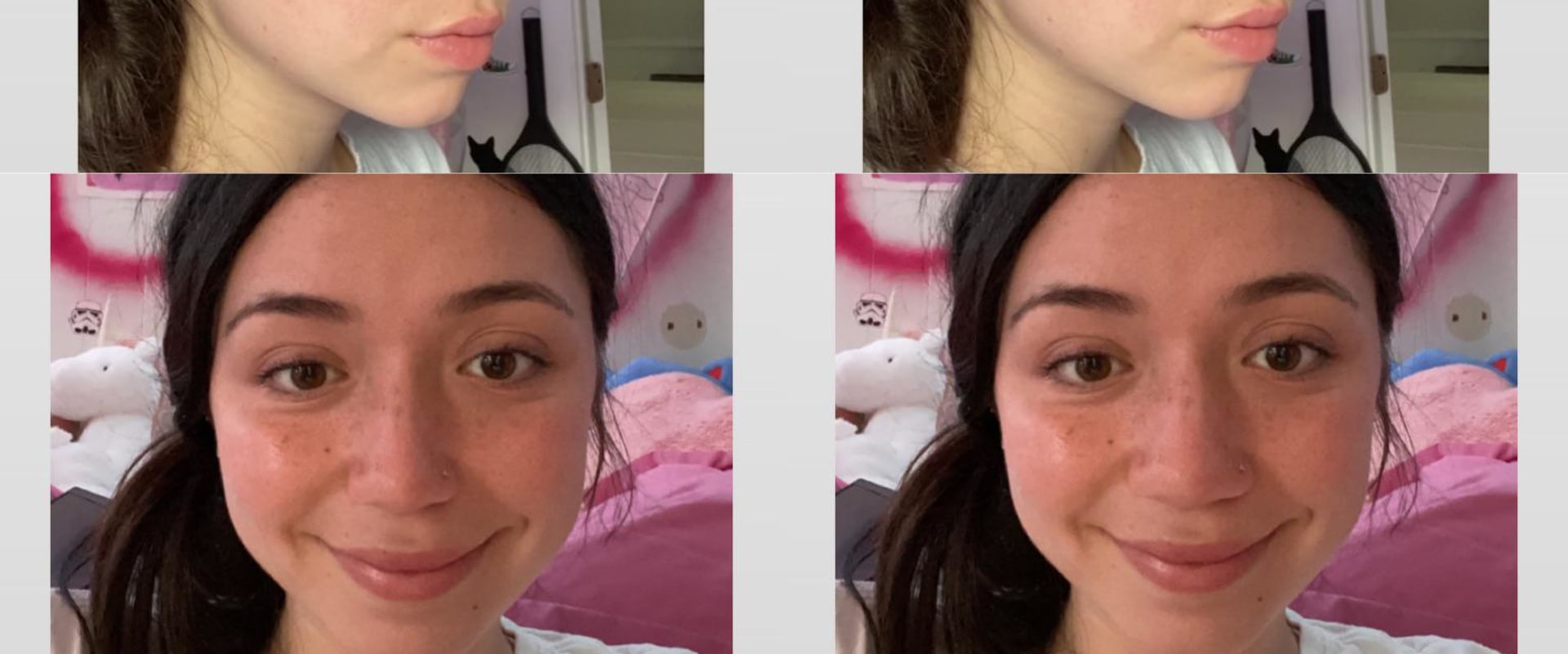 Will plastic surgery make me feel better?