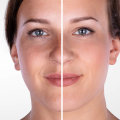What class of med is botox?