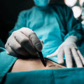 What is the riskiest cosmetic surgery?