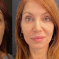 What is the word for surgery for looks?