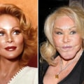 Are people satisfied after plastic surgery?
