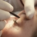 Why is plastic surgeon called plastic?