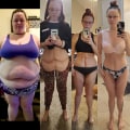 What happens years after a tummy tuck?