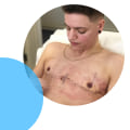 How long can you not lift after top surgery?