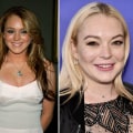 Do people change after plastic surgery?