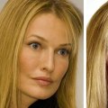 How many people disagree with plastic surgery?