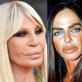 How often is cosmetic surgery botched?