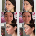 Will plastic surgery make me feel better?