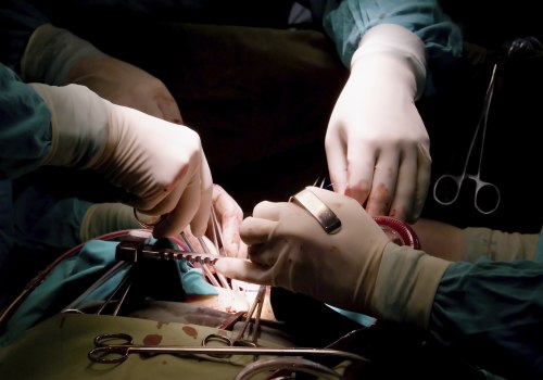 What surgery has the highest complication rate?