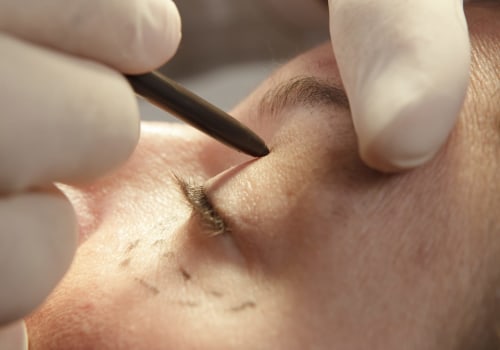 Is all cosmetic surgery plastic surgery?