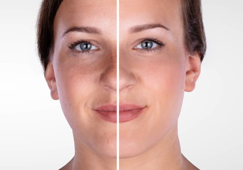 What class of med is botox?