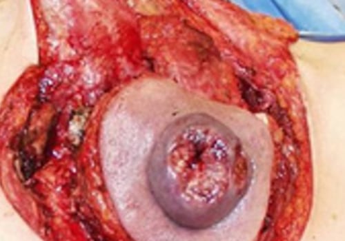 What does plastic stand for in plastic surgery?