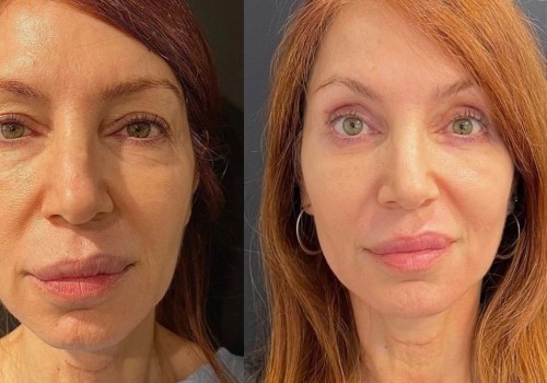 What is the word for surgery for looks?