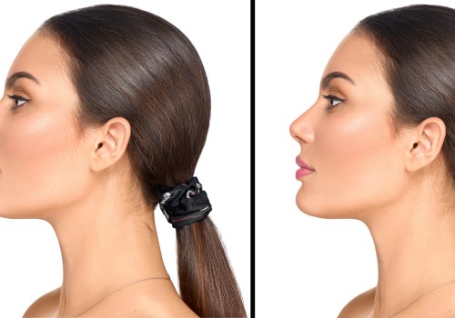 What is the most painful plastic surgery to recover from?