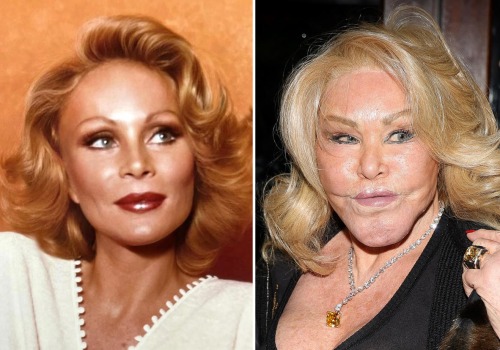 Are people satisfied after plastic surgery?