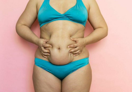 How do you know if you had a bad tummy tuck?