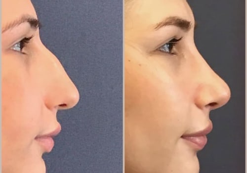Why plastic surgery is the best specialty?