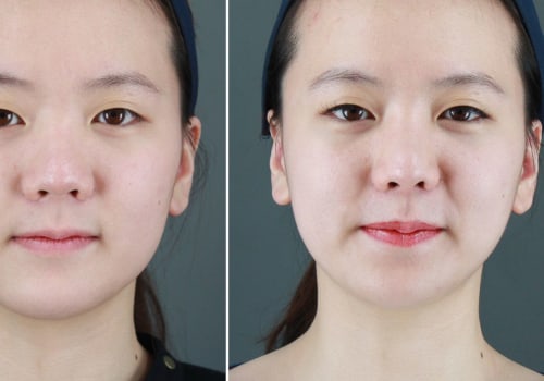 How many people are happy with cosmetic surgery?