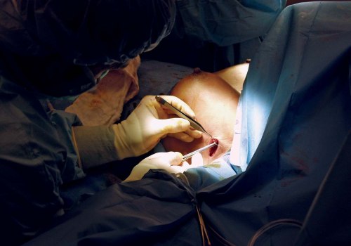 What is a fancy name for plastic surgery?